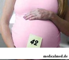 Вес малыша на 42 неделе беременности - более 3,6 кг