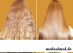 До и после бразильского выпрямления волос