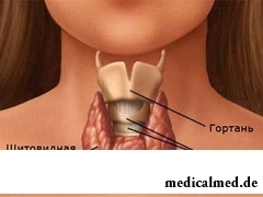 Диффузный токсический зоб характеризуется увеличением в размерах щитовидной железы