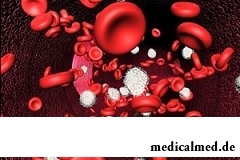 Гипокалиемия - пониженное содержание в крови человека калия