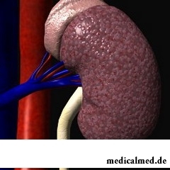 Инфаркт почки происходит в результате гибели почечной ткани 