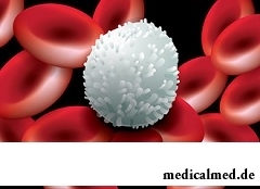 Лейкоцитоз - состояние, характеризующееся избытком белых кровяных телец в крови