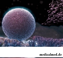 Олигоастенотератозооспермия – снижение концентрации сперматозоидов