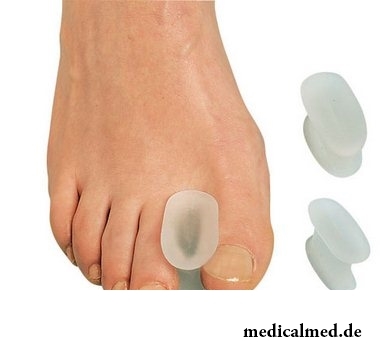 Корригирующее приспособление для лечения деформированных пальцев стопы