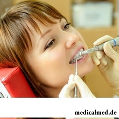 Процедура отбеливания зубов