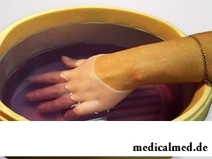 Парафинотерапия - лечебная ванночка для рук