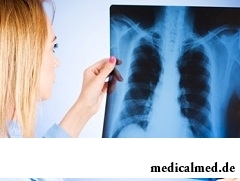 Рентгенологическое исследование - метод диагностики пневмофиброза легких