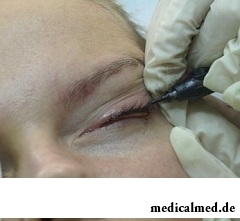 Процедура нанесения татуажа глаз