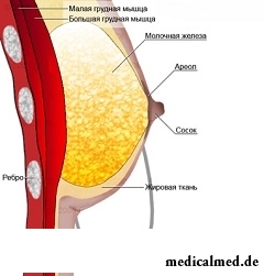 Операция по уменьшению груди называется редукционной маммопластикой