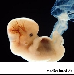 6 недель беременности - 4 недели эмбриону