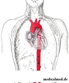 Схема грудной аорта у человека