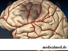 Нарушение мозгового кровообращения - это нарушение кровообращения в системе сосудов головного и спинного мозга