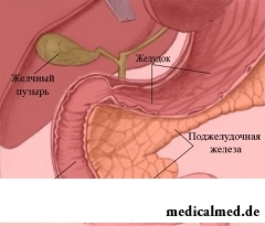 Панкреатит - воспаление поджелудочной железы