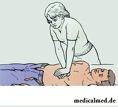 Непрямой массаж сердца - первая помощь при несчастном случае, если нет дыхания