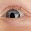 Воспаление глаза у ребенка
